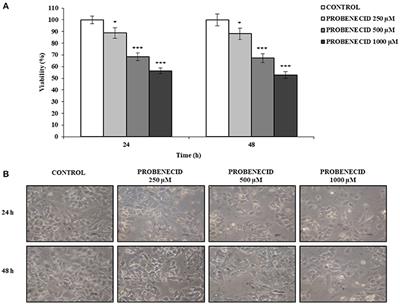 Extracellular ATP Regulates CD73 and ABCC6 Expression in HepG2 Cells